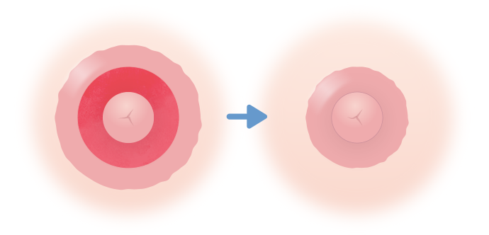 乳頭の根本を縮小する方法