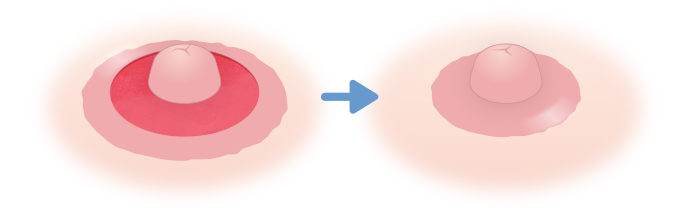 乳頭の根本を縮小する方法